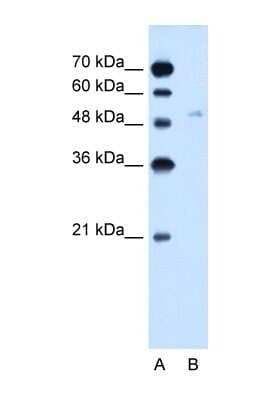 Western Blot: Glucose Transporter GLUT6 Antibody [NBP1-59891]