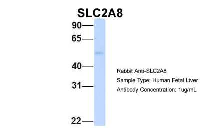 Western Blot: Glucose Transporter GLUT8 Antibody [NBP1-59812]