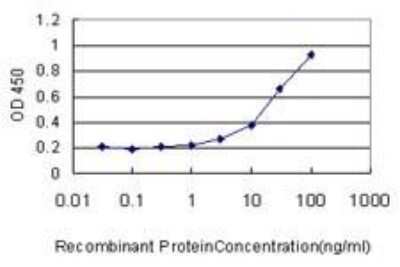 ELISA: Glucosylceramidase/GBA Antibody (2E2) [H00002629-M01]