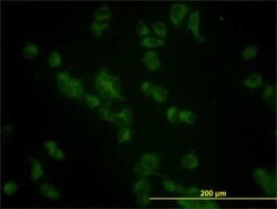 Immunocytochemistry/ Immunofluorescence: Glucosylceramidase/GBA Antibody (2E2) [H00002629-M01]