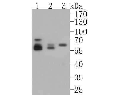 Western Blot: Glucosylceramidase/GBA Antibody (JM10-76) [NBP2-66871]