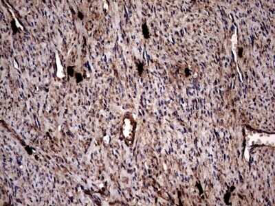 Immunohistochemistry: Glucosylceramidase/GBA Antibody (OTI4G4) - Azide and BSA Free [NBP2-70803]