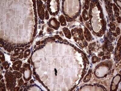 Immunohistochemistry: Glucosylceramidase/GBA Antibody (OTI4G4) - Azide and BSA Free [NBP2-70803]