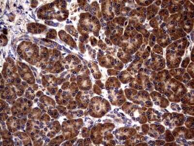 Immunohistochemistry: Glucosylceramidase/GBA Antibody (OTI4G4) - Azide and BSA Free [NBP2-70803]