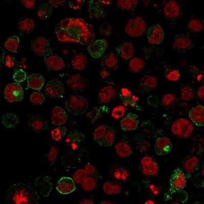 Immunocytochemistry/ Immunofluorescence: Glut1 Antibody (GLUT1/2475) - Azide and BSA Free [NBP2-75786]