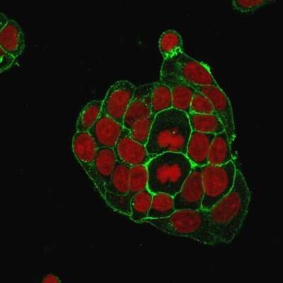 Immunocytochemistry/ Immunofluorescence: Glut1 Antibody (GLUT1/2476) [NBP2-75785]