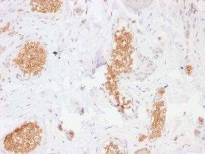 Immunohistochemistry-Paraffin: Glut1 Antibody (GLUT1/2476) [NBP2-75785]