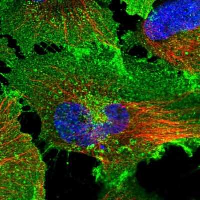 Immunocytochemistry/ Immunofluorescence: Glut1 Antibody [NBP2-48609]