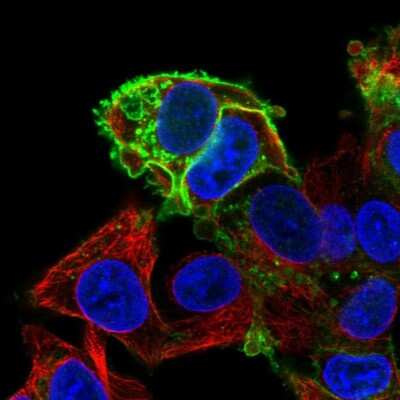 Immunocytochemistry/ Immunofluorescence: Glut1 Antibody [NBP2-54745]