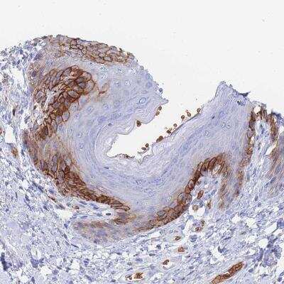 Immunohistochemistry-Paraffin: Glut1 Antibody [NBP2-48609]