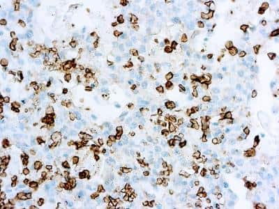 Immunohistochemistry-Paraffin: Glut1 Antibody [NB120-15309]