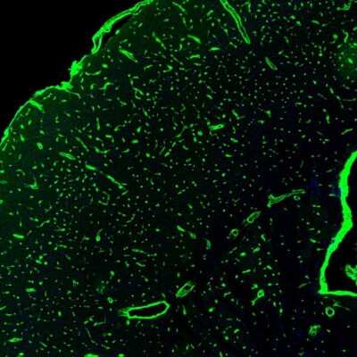 Immunohistochemistry: Glut1 Antibody [NBP2-48609]