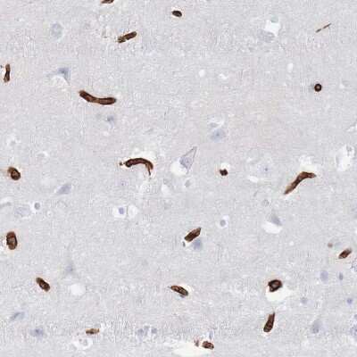 Immunohistochemistry-Paraffin: Glut1 Antibody [NBP2-48609]