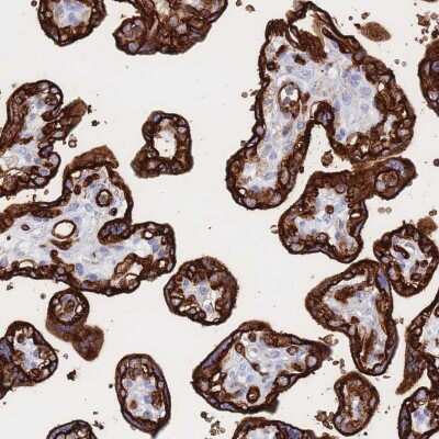Immunohistochemistry-Paraffin: Glut1 Antibody [NBP2-48609]