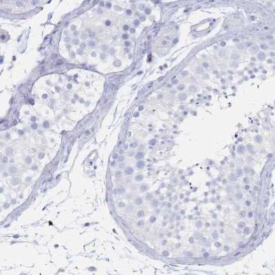 Immunohistochemistry-Paraffin: Glut1 Antibody [NBP2-48609]