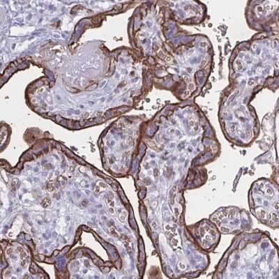 Immunohistochemistry-Paraffin: Glut1 Antibody [NBP2-54745]