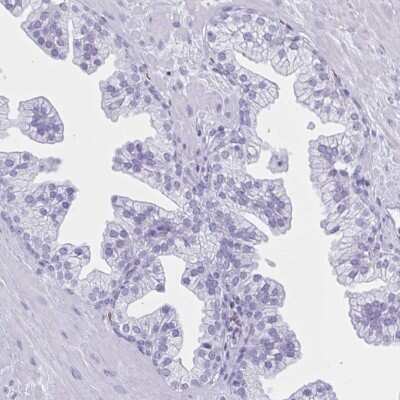 Immunohistochemistry-Paraffin: Glut1 Antibody [NBP2-54745]