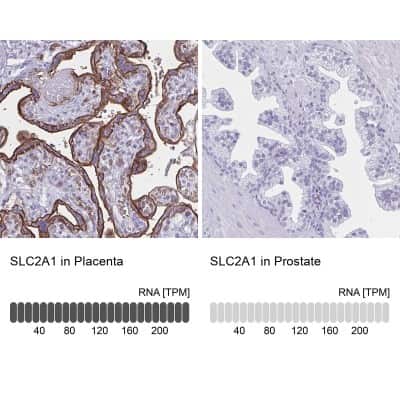 Immunohistochemistry-Paraffin: Glut1 Antibody [NBP2-54745]
