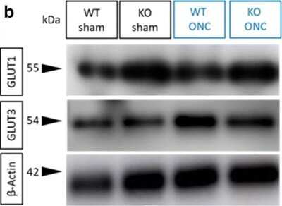 Western Blot: Glut1 Antibody [NB300-666]