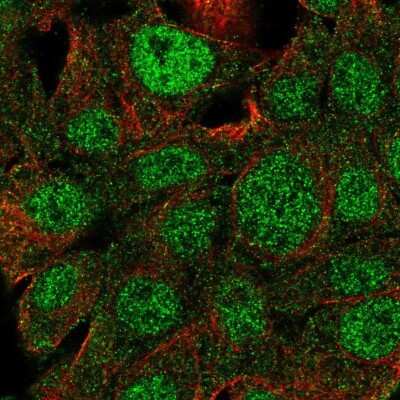 Immunocytochemistry/ Immunofluorescence: Glut2 Antibody [NBP2-58182]