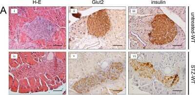 Immunohistochemistry-Paraffin: Glut2 Antibody - BSA Free [NBP2-22218]