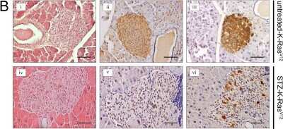 Immunohistochemistry-Paraffin: Glut2 Antibody - BSA Free [NBP2-22218]