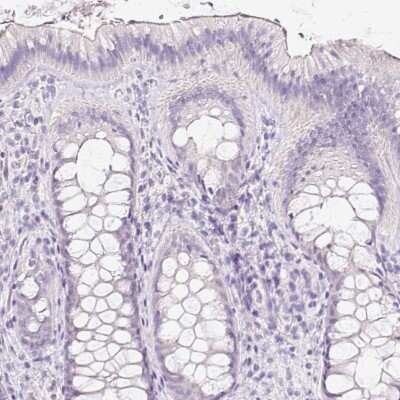 Immunohistochemistry-Paraffin: Glut2 Antibody [NBP2-48586]