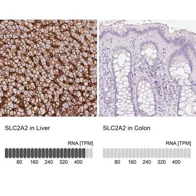 Immunohistochemistry-Paraffin: Glut2 Antibody [NBP2-48586]