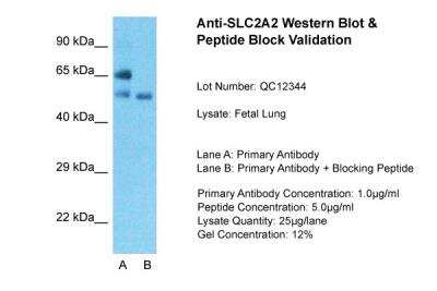 Western Blot: Glut2 Antibody [NBP1-69466]