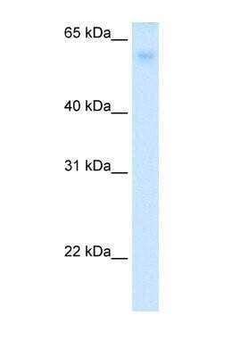 Western Blot: Glut2 Antibody [NBP1-69466]