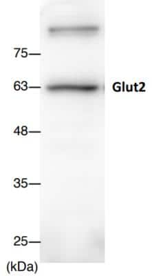 Western Blot: Glut2 AntibodyBSA Free [NBP2-22218]