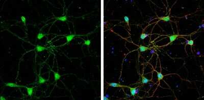 Immunocytochemistry/ Immunofluorescence: Glut3 Antibody [NBP3-12885]