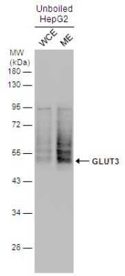 Western Blot: Glut3 Antibody [NBP3-12885]