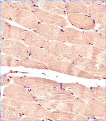Immunohistochemistry-Paraffin: Glut4 Antibody (2E11NB) - Azide and BSA Free [NBP2-80754]