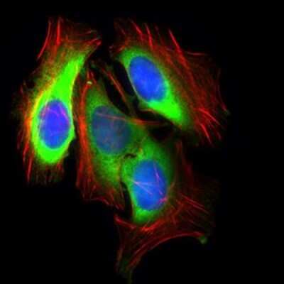 Immunocytochemistry/ Immunofluorescence: Glut4 Antibody (3G10A3) - BSA Free [NBP2-22214]