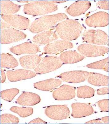 Immunohistochemistry-Paraffin: Glut4 Antibody (6H11NB) - BSA Free [NBP2-44298]