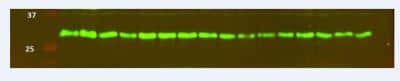 Western Blot: Glut4 Antibody [NBP1-49840]