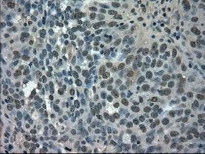 Immunohistochemistry-Paraffin: Glut5 Antibody (OTI9F3) [NBP1-47980]
