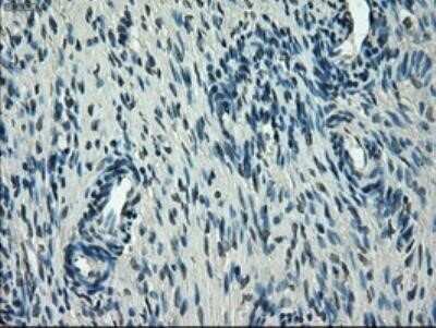 Immunohistochemistry-Paraffin: Glut5 Antibody (OTI9F3) [NBP1-47980]