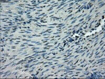 Immunohistochemistry-Paraffin: Glut5 Antibody (OTI9F3) [NBP1-47980]