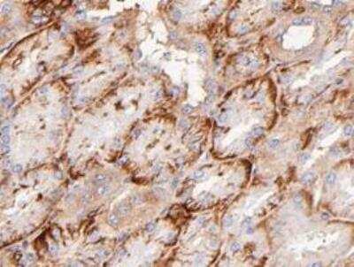 Immunohistochemistry-Paraffin: Glut5 Antibody (OTI9F3) [NBP1-47980]