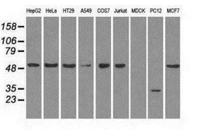 Western Blot: Glut5 Antibody (OTI9F3) [NBP1-47980]