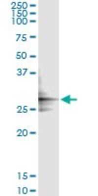 Immunoprecipitation: Glutamate Dehydrogenase 2/GLUD2 Antibody (3C2) [H00002747-M01]