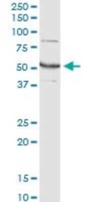 Western Blot: Glutamate Dehydrogenase 2/GLUD2 Antibody (3C2) [H00002747-M01]