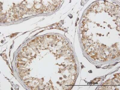 Immunohistochemistry-Paraffin: Glutamate Dehydrogenase 2/GLUD2 Antibody [H00002747-B02P]