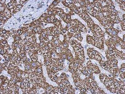Immunohistochemistry-Paraffin: Glutamate Dehydrogenase 2/GLUD2 Antibody [NBP2-16678]