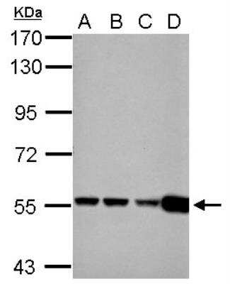 Western Blot: Glutamate Dehydrogenase 2/GLUD2 Antibody [NBP2-16678]