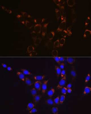 Immunocytochemistry/ Immunofluorescence: Glutamate Dehydrogenase Antibody (7L7N2) [NBP3-16582]