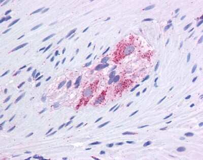 Immunohistochemistry-Paraffin: Glutamate Dehydrogenase Antibody [NBP1-54962]