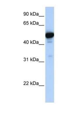 Western Blot: Glutamate Dehydrogenase Antibody [NBP1-54962]